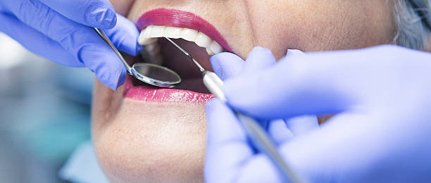 Best Urgent Dental Care for Toothaches in Henderson, TX